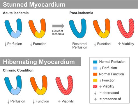 hibernating myocardium